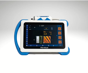 FibroScan ile Karaciğer Sağlığına Net Bakış