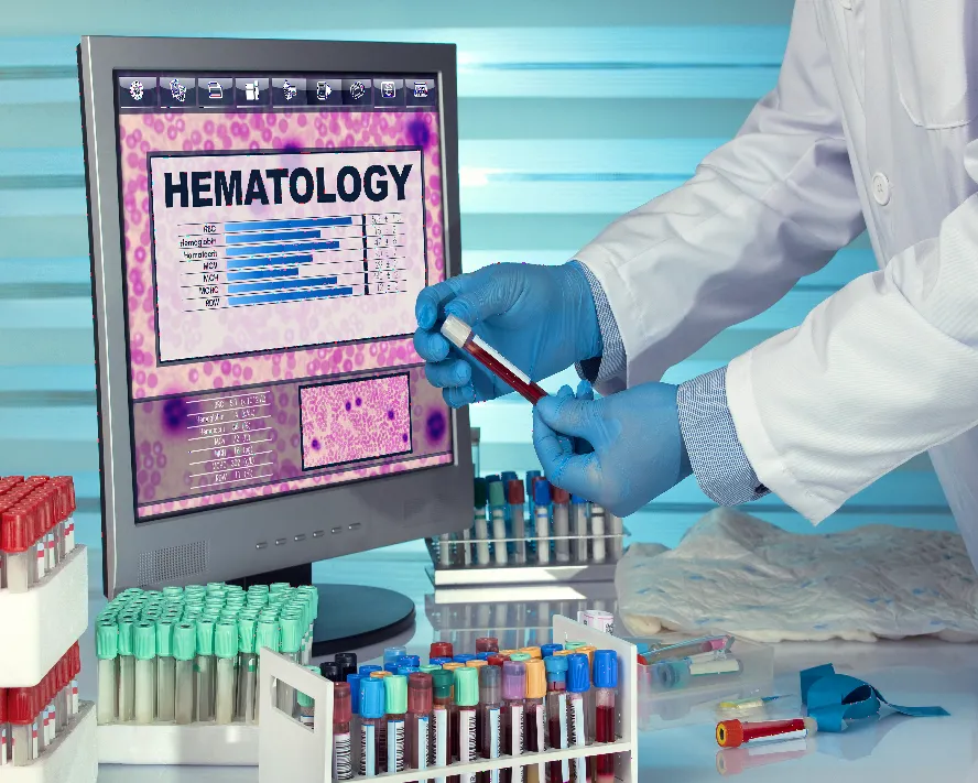 Hemogram (Tam Kan Sayımı): Bilmeniz Gerekenler
