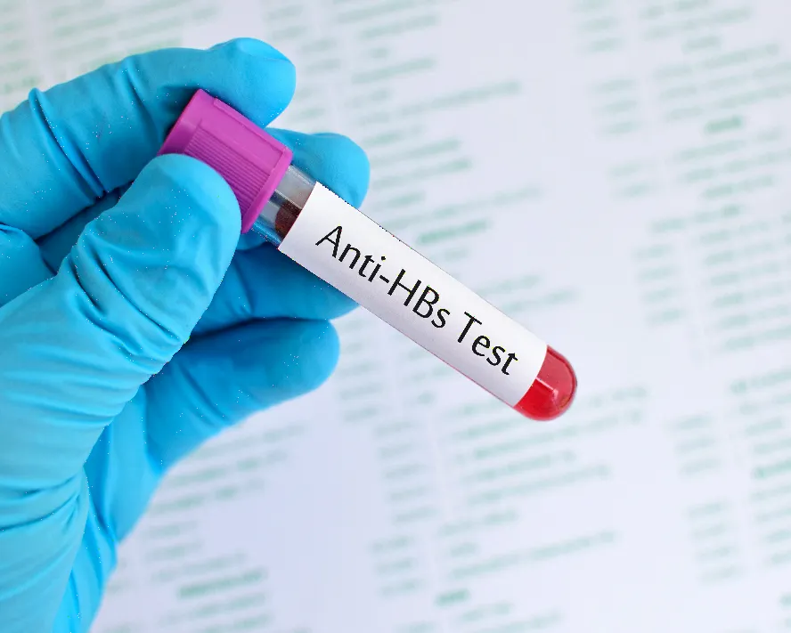 &nbsp;Anti HBs Nedir? Yüksekliği ve Düşüklüğü Ne Anlama Gelir?&nbsp;