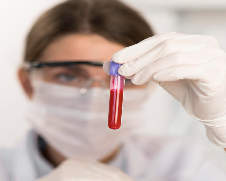 Anti HCV Testi: Sonuçlar ve Hasta Rehberi