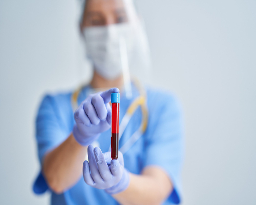 AST (Aspartat Aminotransferaz) Nedir, Neden Yükselir ve Düşer?