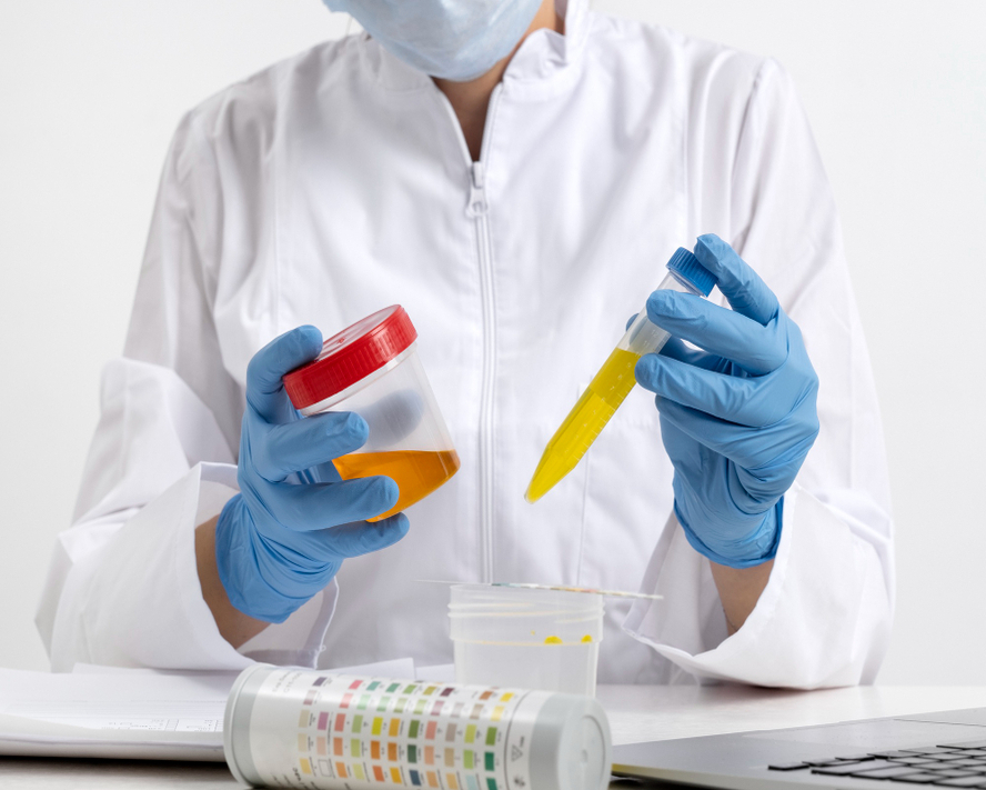 Böbrekte Protein Kaçağı Öldürür mü? Bilmeniz Gerekenler