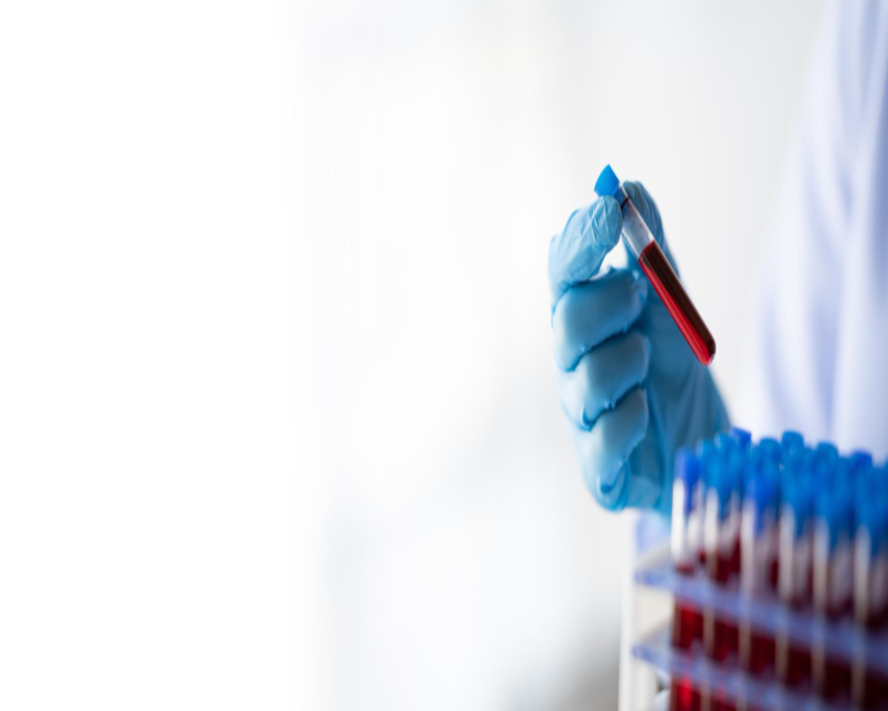 Hematolojik Testler Nedir? Kan Sağlığınızı Anlamanın Anahtarı