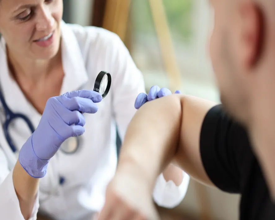 Onkolojik Dermatoloji (Deri Kanserleri)