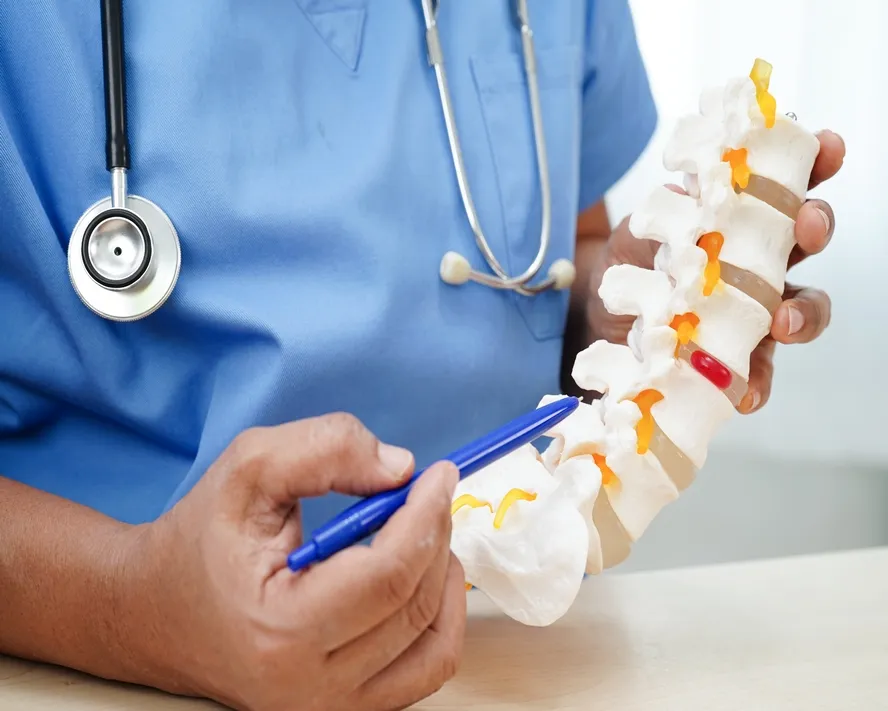 Kanal Daralması (Spinal Stenoz) Nedir? Belirtileri ve Nedenleri