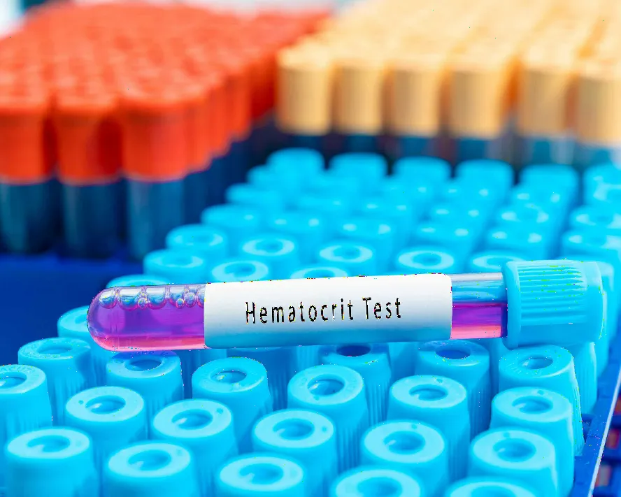 Hct (Hematokrit) Nedir? Hct Değeri Düşüklüğü