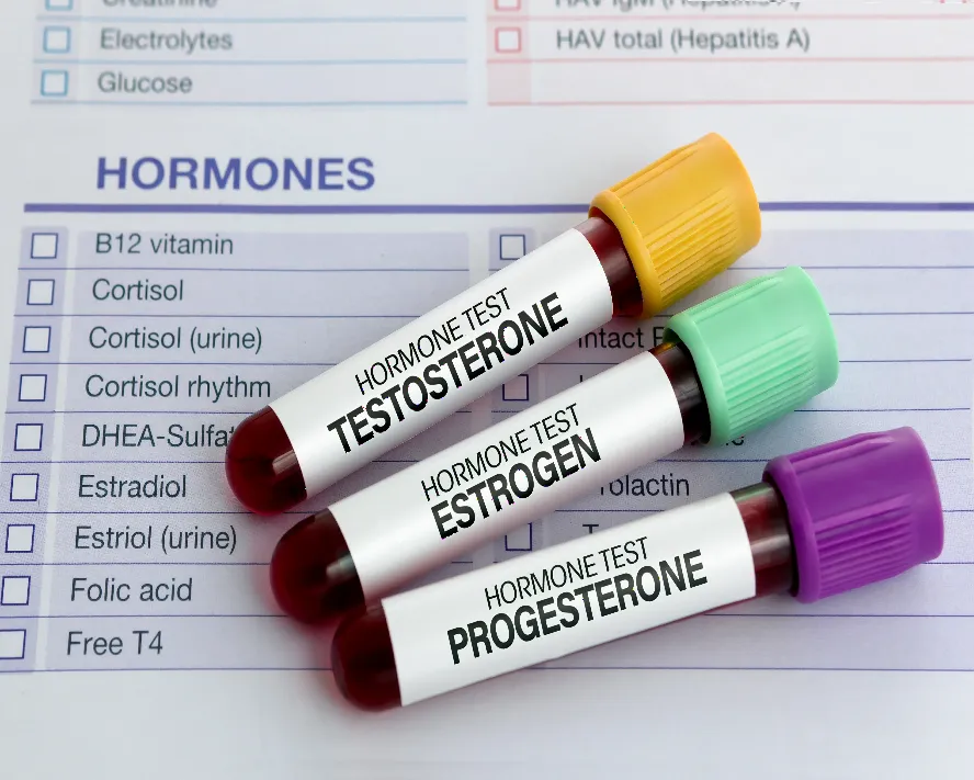Progesteron Hormonu Nedir? Vücuttaki Değeri Kaç Olmalıdır?