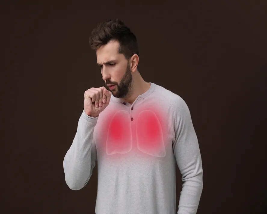 Akciğer Apsesi Nedir? Akciğer Apsesi Belirtileri Nelerdir?