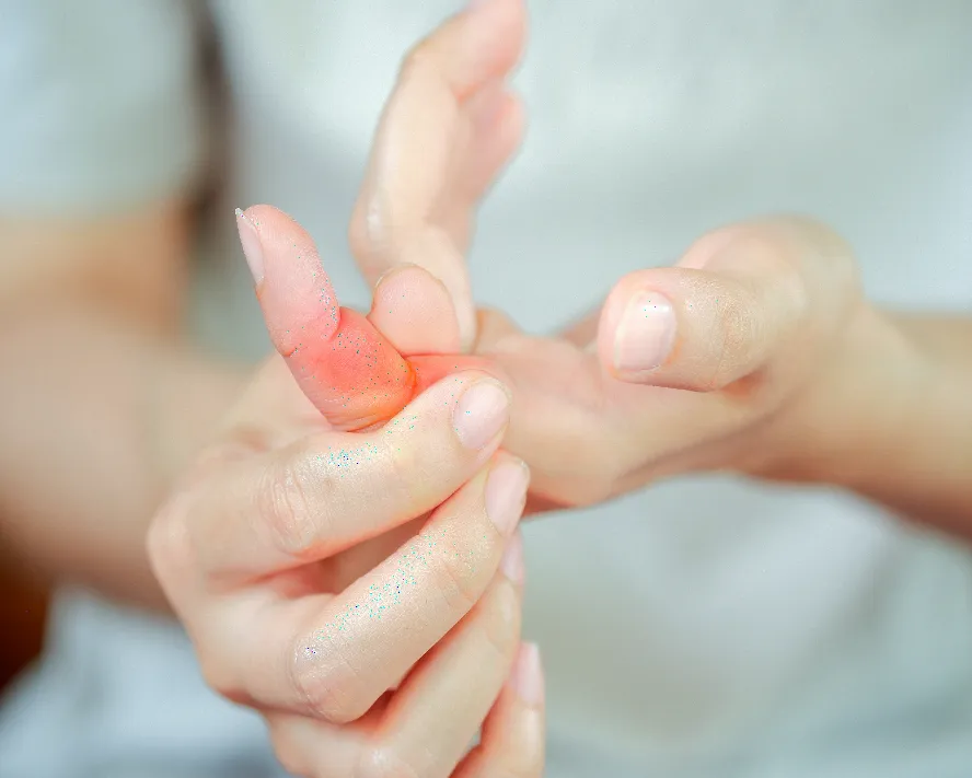 Kemik İltihabı (Osteomyelit) Nedir ve Belirtileri Nelerdir?