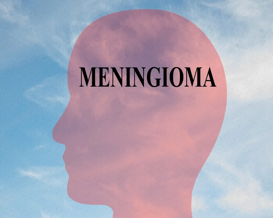 Menenjiomlar Nedir? Tedavisi Nasıl Olur?