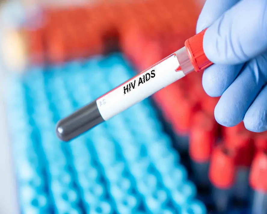 AIDS (HIV) Nedir? AIDS Belirtileri Nelerdir?