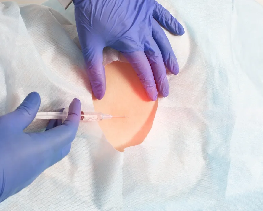 Epidural Doğum Nedir? Nasıl Uygulanır?