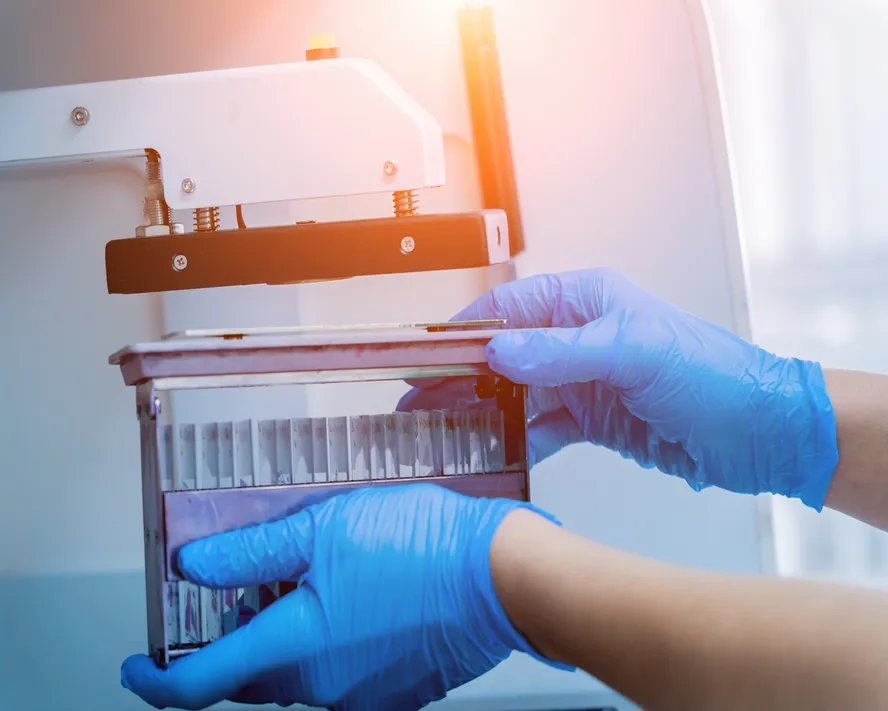 Otomatik Cihazlarla Kapsamlı İmmunohistokimya