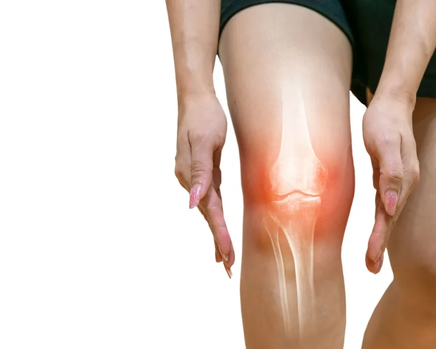 Diz Bölgesi Kırıkları (Patella Kırıkları)