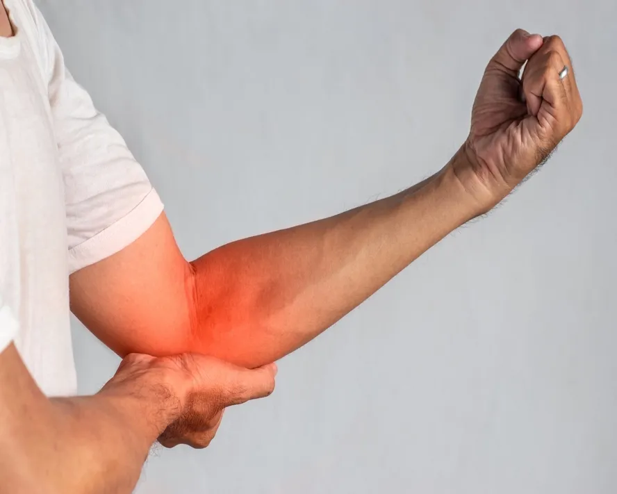 Kubital Tünel Sendromu Nedir? Belirtileri Nelerdir?