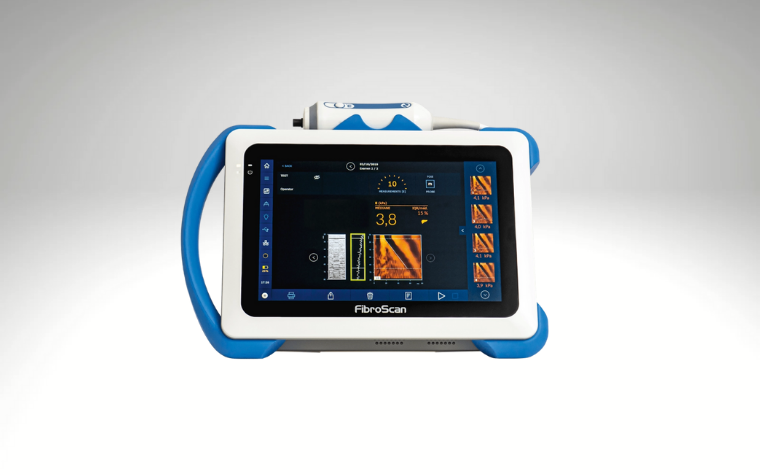DISPOSITIF FIBROSCAN
