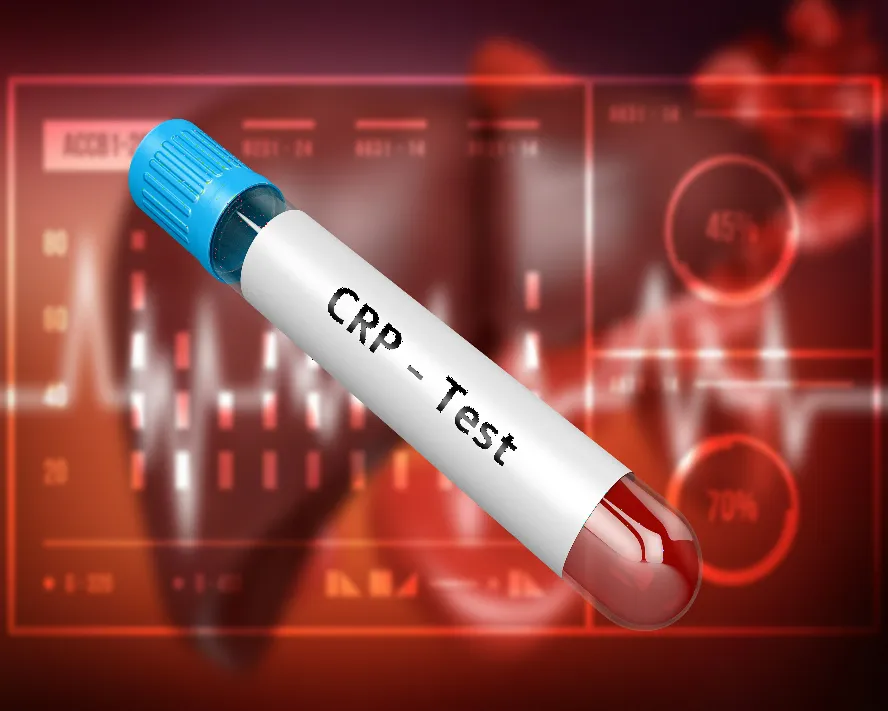 Crp Nedir? Crp Yüksekliği Neden Olur?