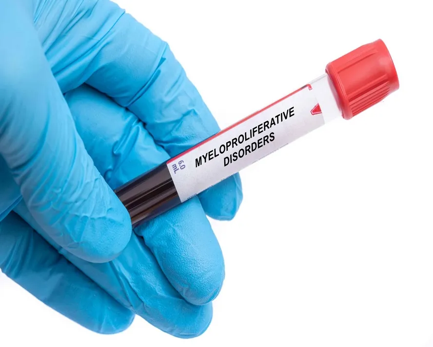 Miyeloproliferatif hastalıklar