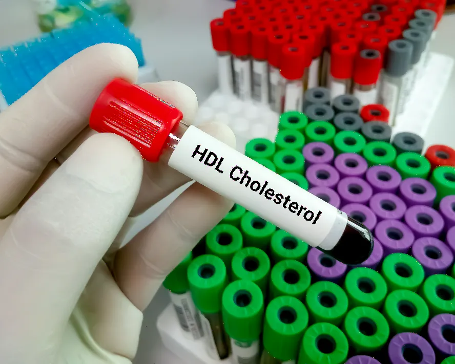 HDL Kolesterol Sağlık İçin Önemlidir