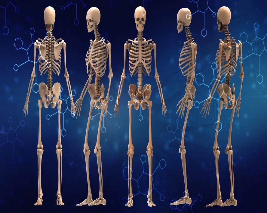 Fibröz Displazi