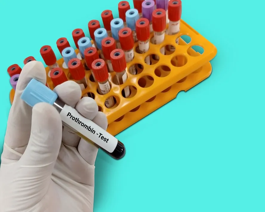 Bu test ile, kanın pıhtılaşması için geçen süre ölçülür. Kanın pıhtılaşması için, vitamin K ve karaciğer tarafından üretilen bir protein (protrombin) gerekir.