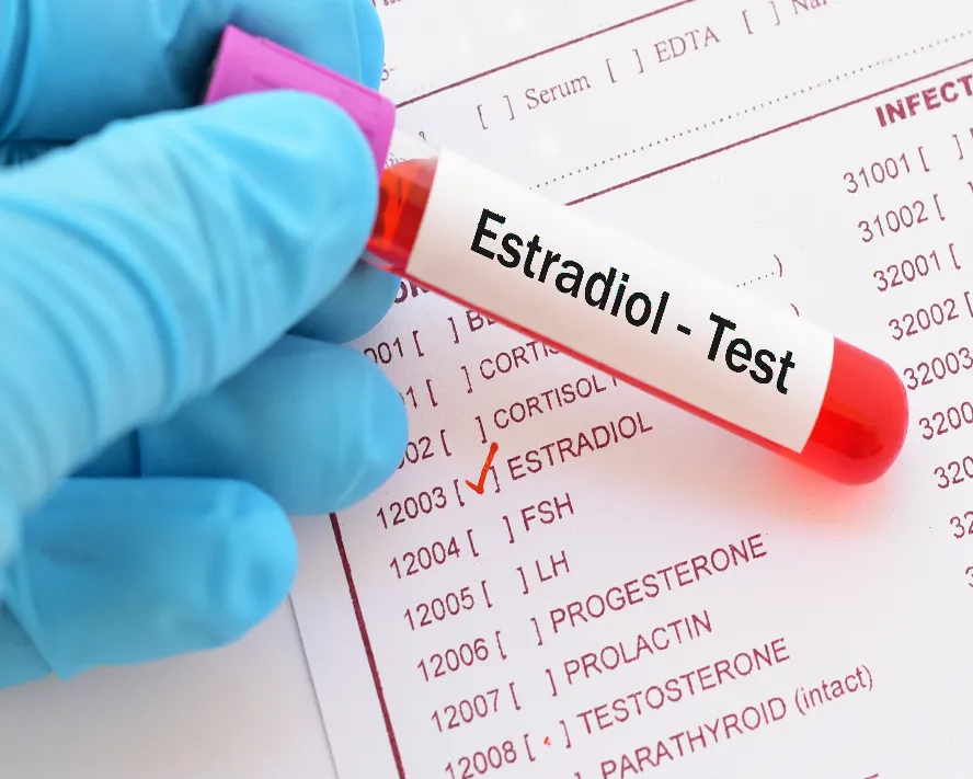 Estradiol (E2) Nedir? Estradiol Kaç Olmalıdır?