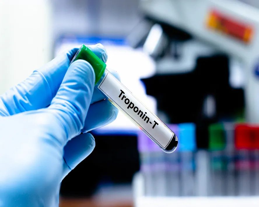 Troponin Nedir? Troponin Yüksekliği ve Düşüklüğü