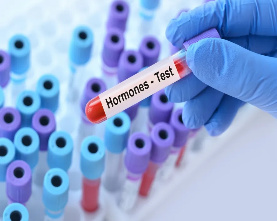 Hormon Testi Nedir, Nasıl Yapılır? Hormon Testi Türleri Nelerdir?&nbsp;