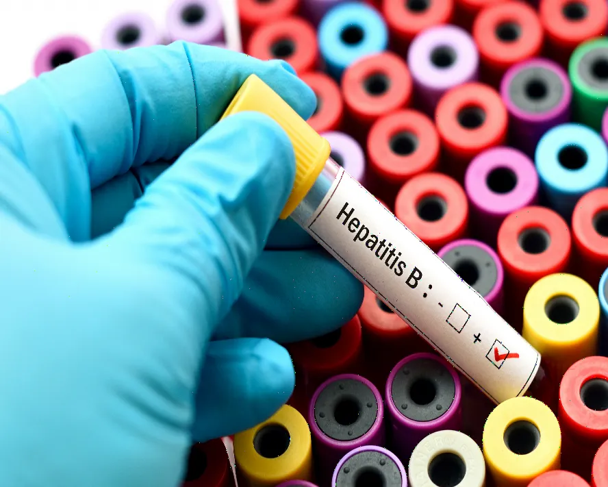 Hepatit B Nedir? Belirtileri Nelerdir?