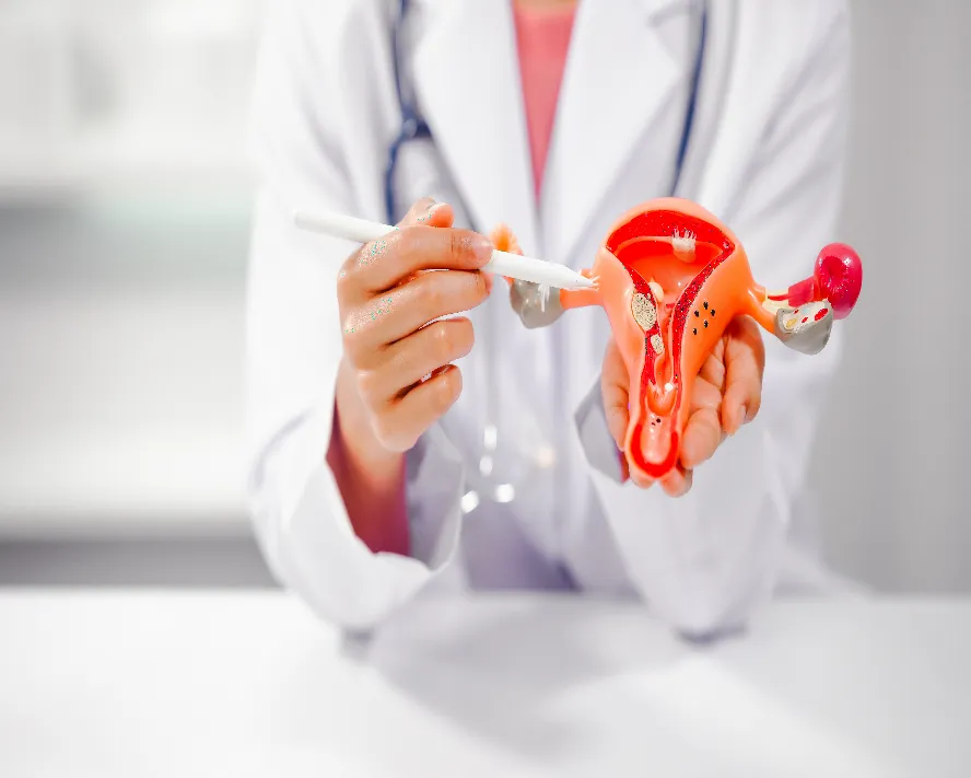Endometriozis (Çikolata Kisti) Nedir? Nasıl Tedavi Edilir?