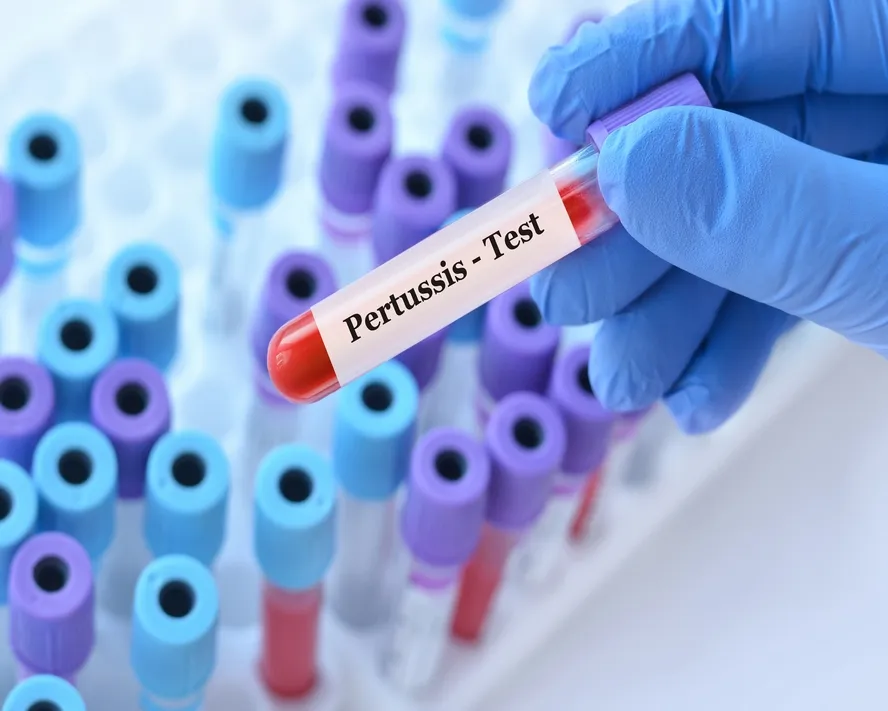 Boğmaca Nedir? Belirtileri ve Tedavisi