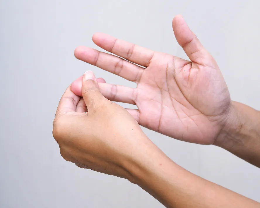Çekiç Parmak (Malled Finger) Deformitesi