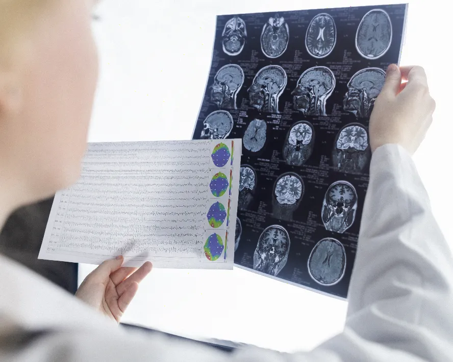 Epilepsi Nedir? Nedenleri ve Tedavisi