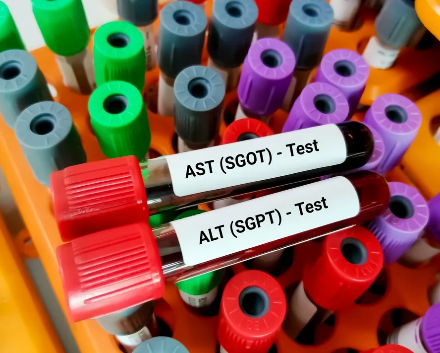 SGOT (AST) ve SGPT (ALT) Nedir?&nbsp;