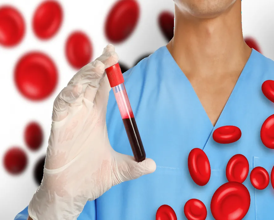Akdeniz Anemisi (Talasemi) Nedir? Belirtileri ve Tedavisi