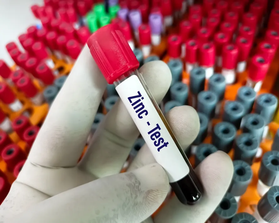 Çinko Testi Nedir?