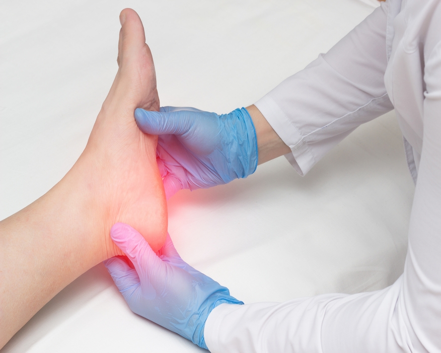 Topuk Dikeni (Plantar Fasiitis) Nedir?