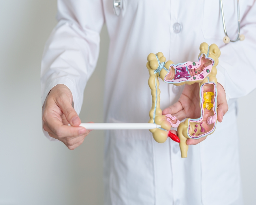 Apandisit Nedir? Belirtileri Nelerdir?