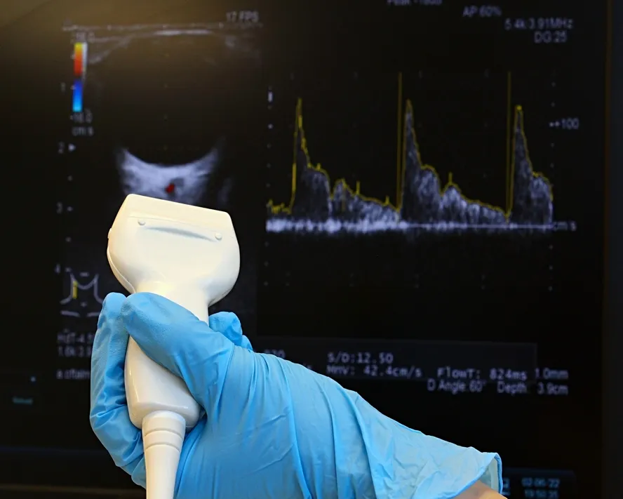Renkli Doppler Ultrasonografi (RDUS) Nedir?&nbsp;